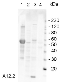 A12,2 | RNA polymerase I subunit (homolog of Pol II Rpb9) in the group Antibodies for Plant/Algal  / DNA/RNA/Cell Cycle / Transcription regulation at Agrisera AB (Antibodies for research) (AS07 225)